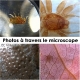 Microscope iPhone 5